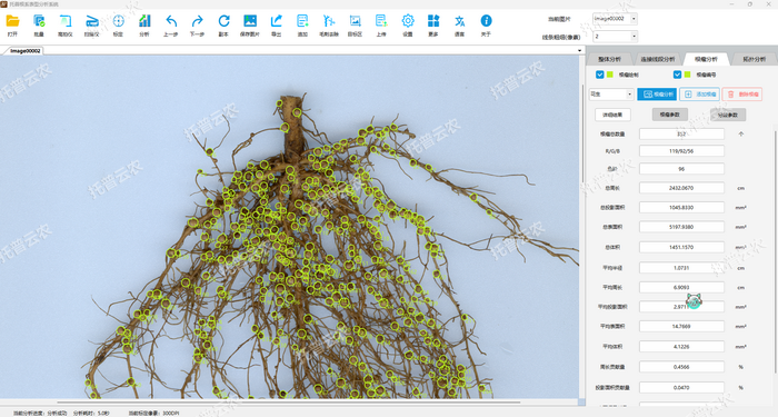 1757053188378415.png »¨Éú-¸ùÁöÆÊÎö.png